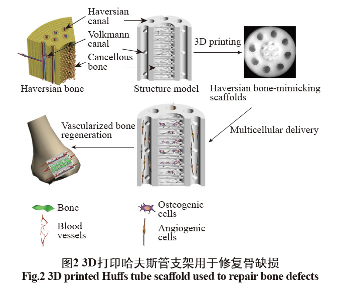 數(shù)字光處理生物3D打印技術(shù)在醫(yī)學上的應(yīng)用發(fā)展